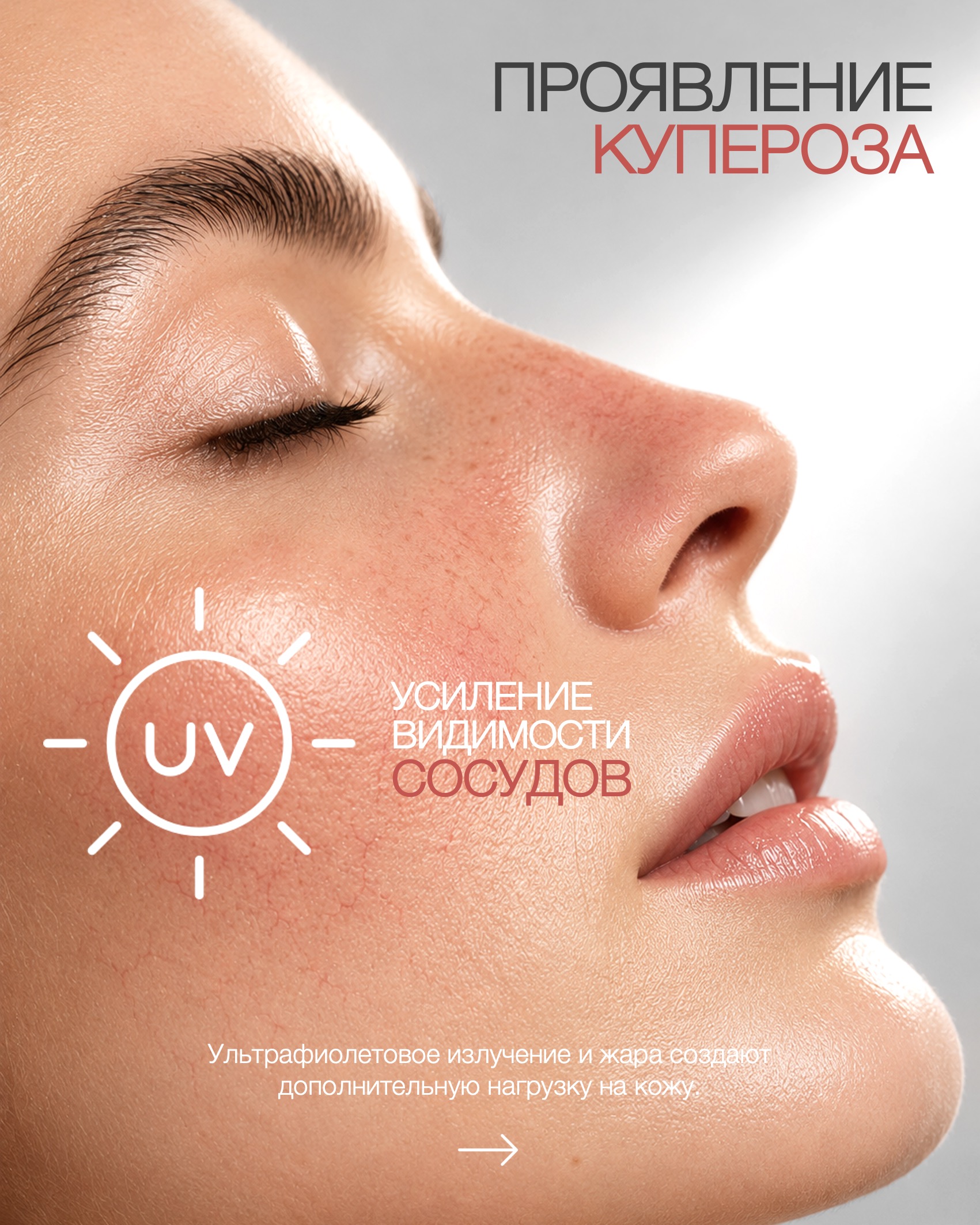 Пост сосуды купероз после лета 2.jpg Пост сосуды купероз после лета 2.jpg